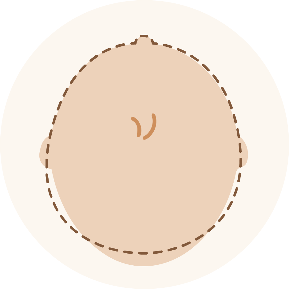 주상두증